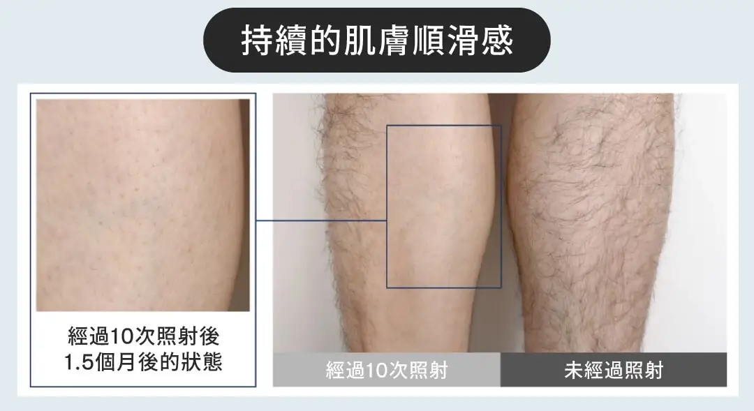 20250903 Mytrex Miray Landing page v2 09