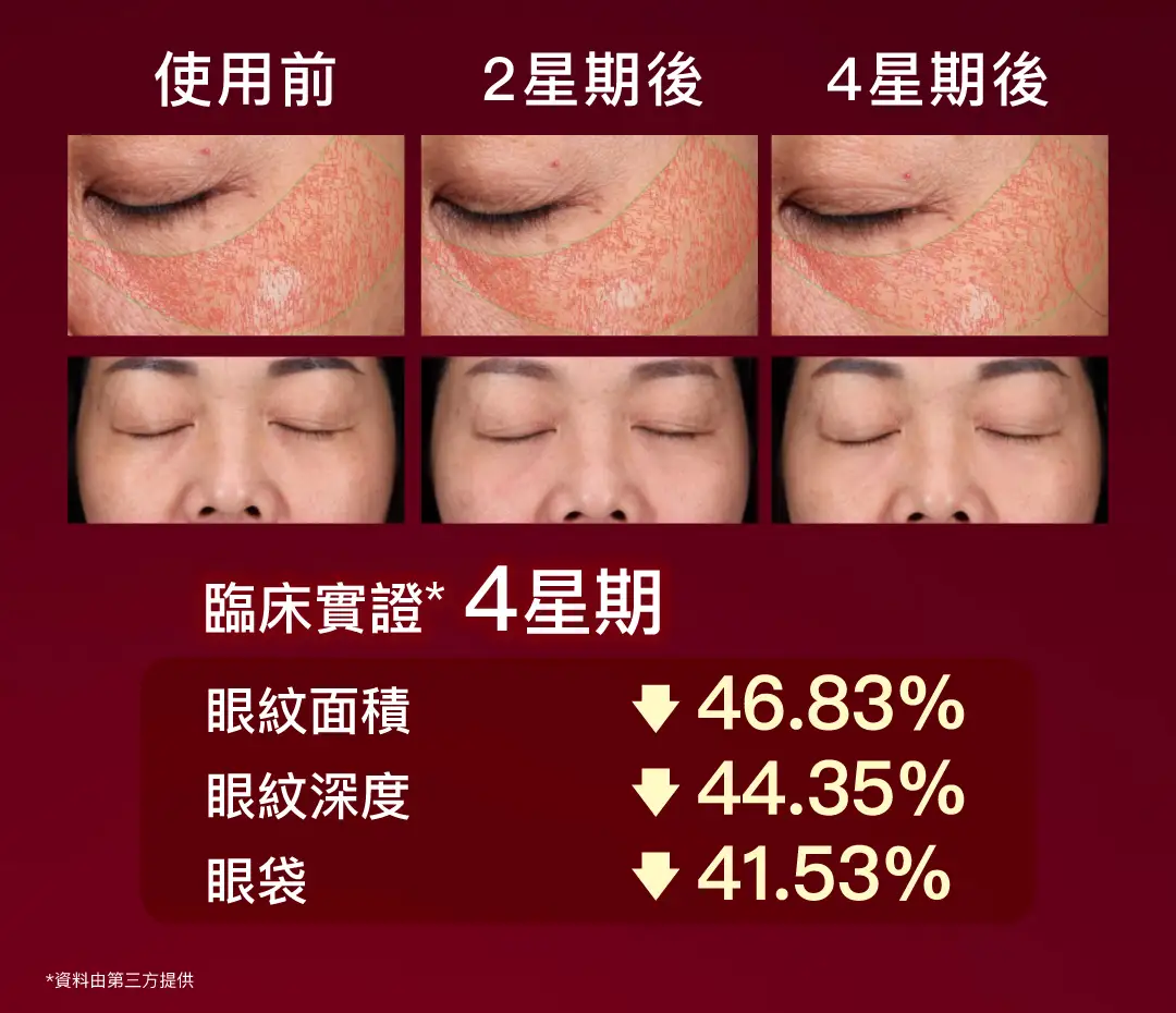 紅紋石超提拉眼精華臨床實證*4星期眼紋面積-46.83%、深度-44.35%、眼袋體積-41.53%