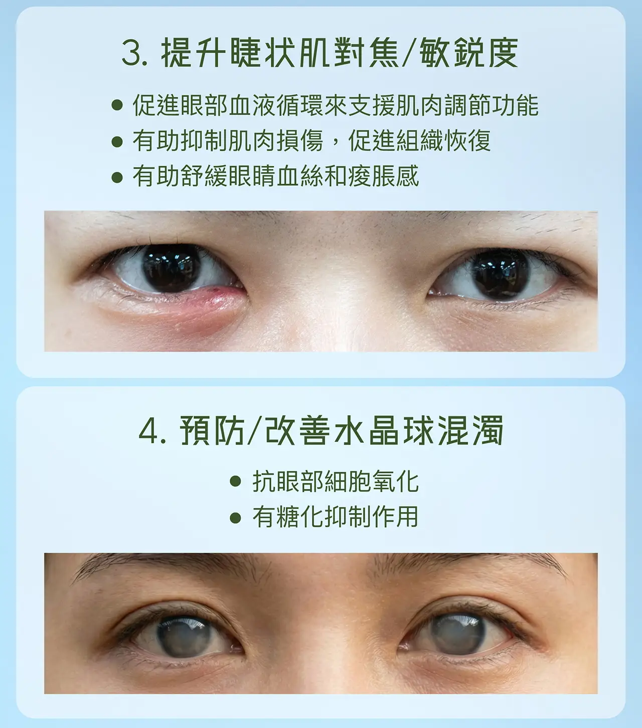 20251126 POME Eye Supplement Landing Page v2 24