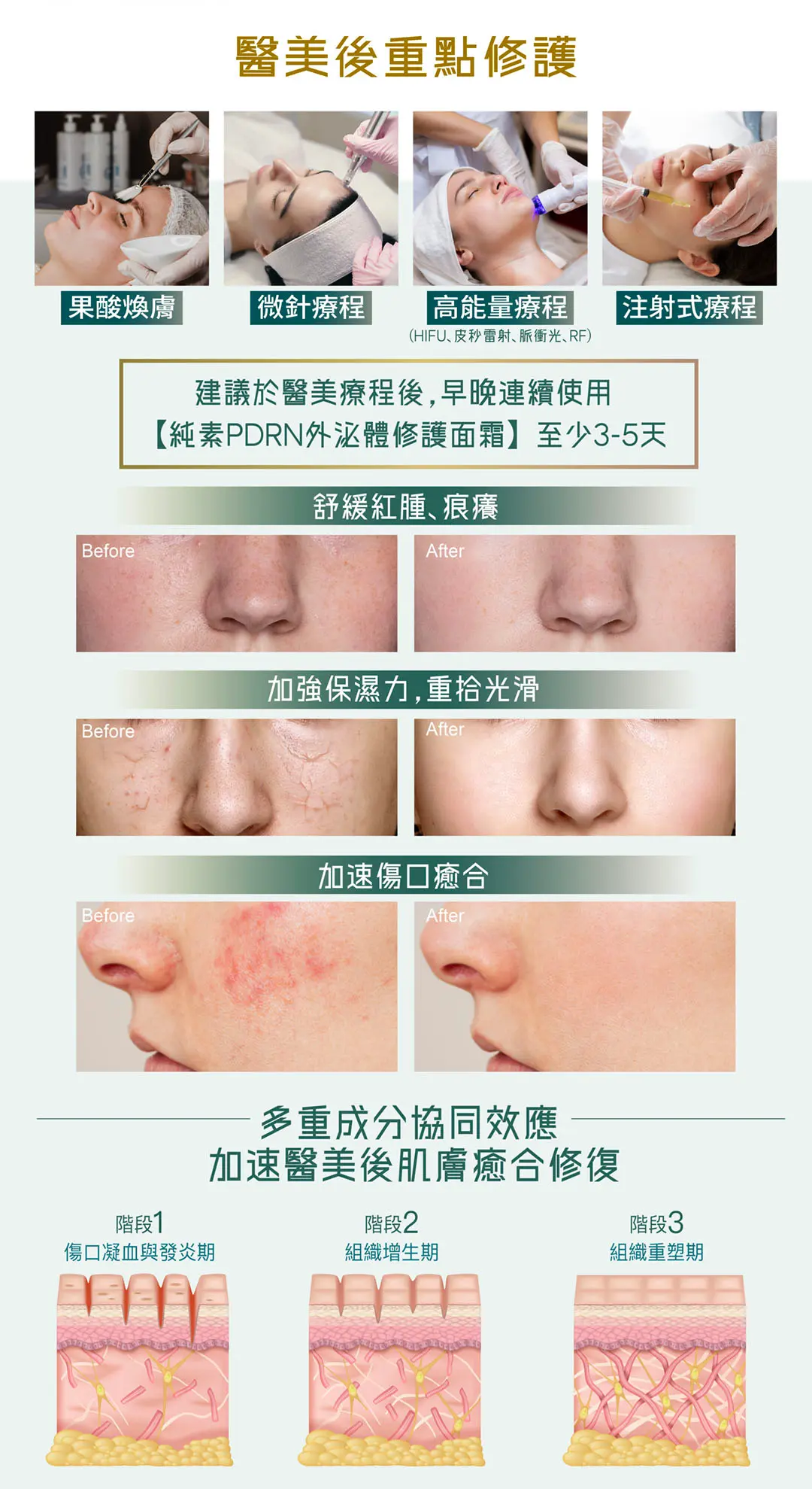 INVITY New Launch Landing Page PDRN Cream Collagen Serum V3 8