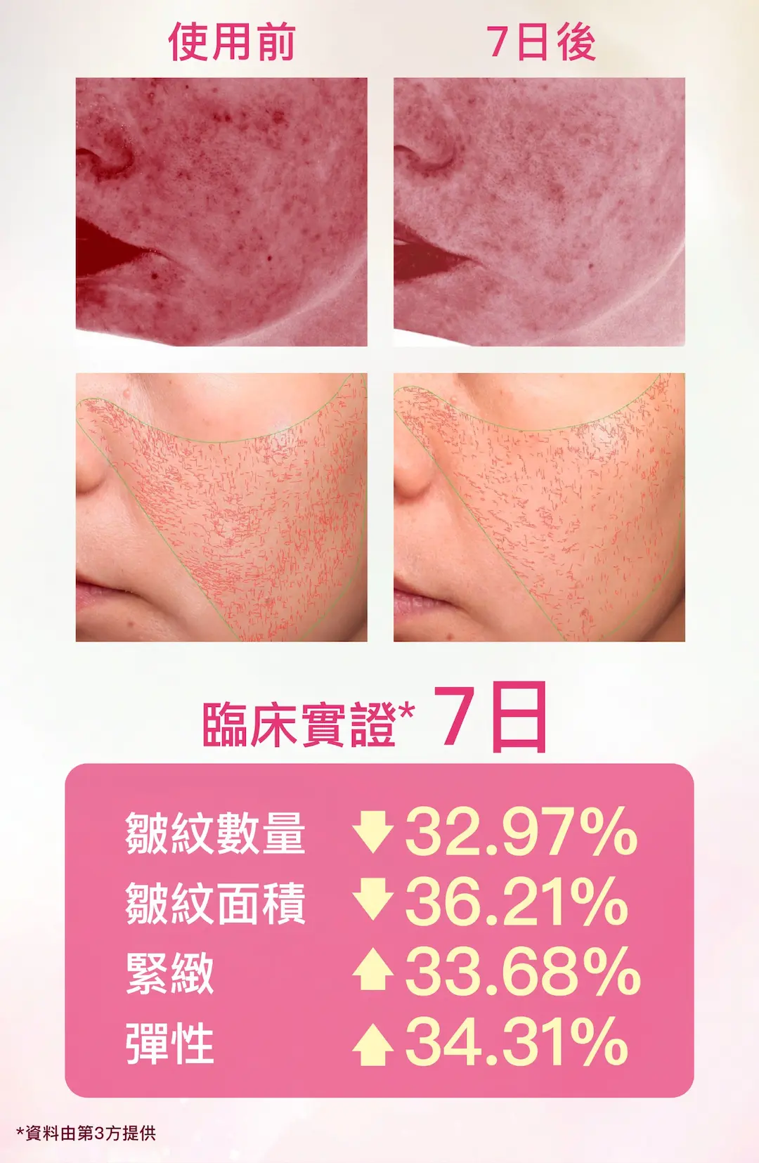 LYI essenceoil clinical