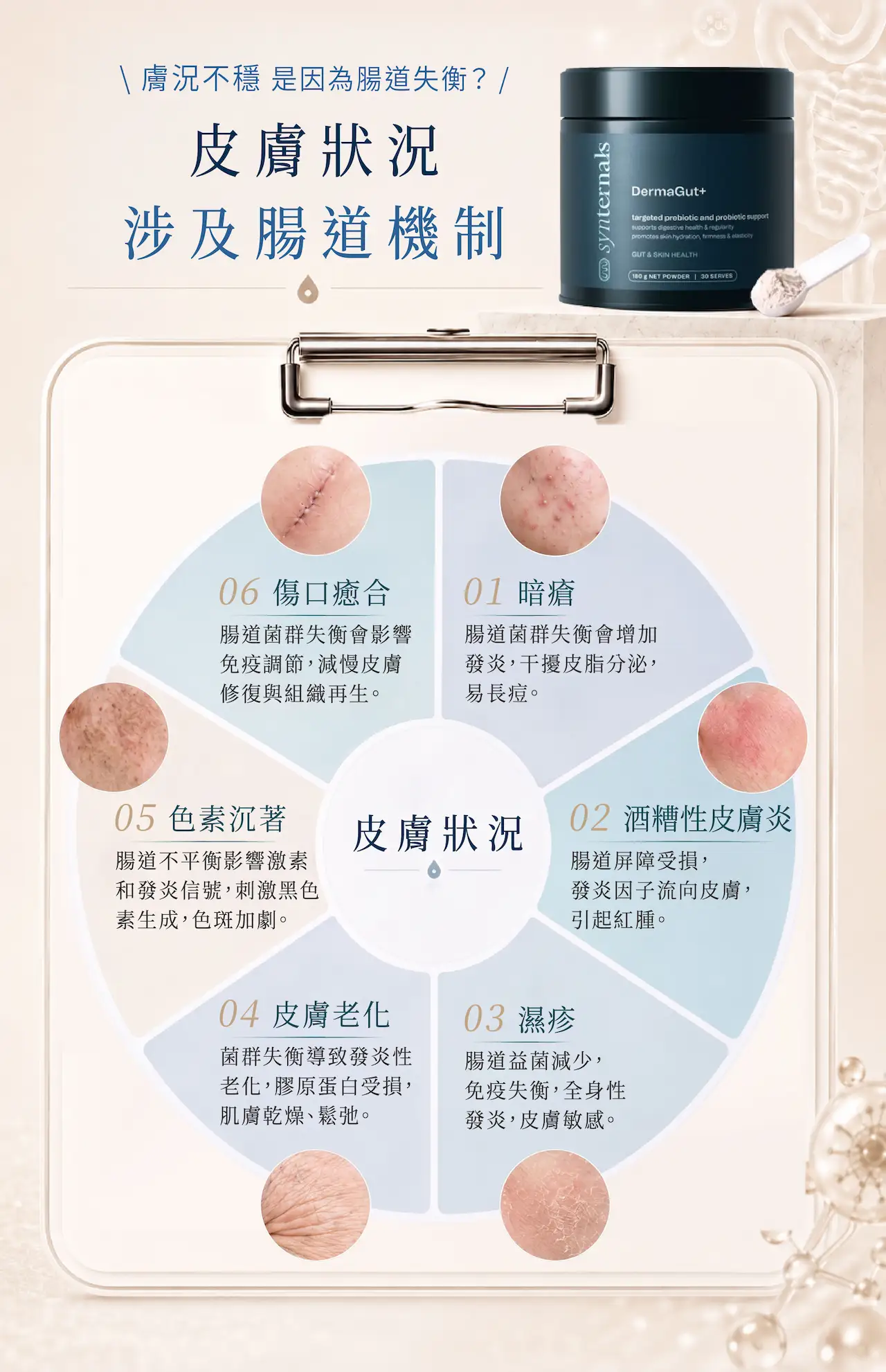 腸皮軸Gut Skin Axis：腸道菌群失衡可能影響皮膚敏感、暗瘡、濕疹、皮膚老化及色素沉著，DermaGut+從腸道健康支持肌膚穩定