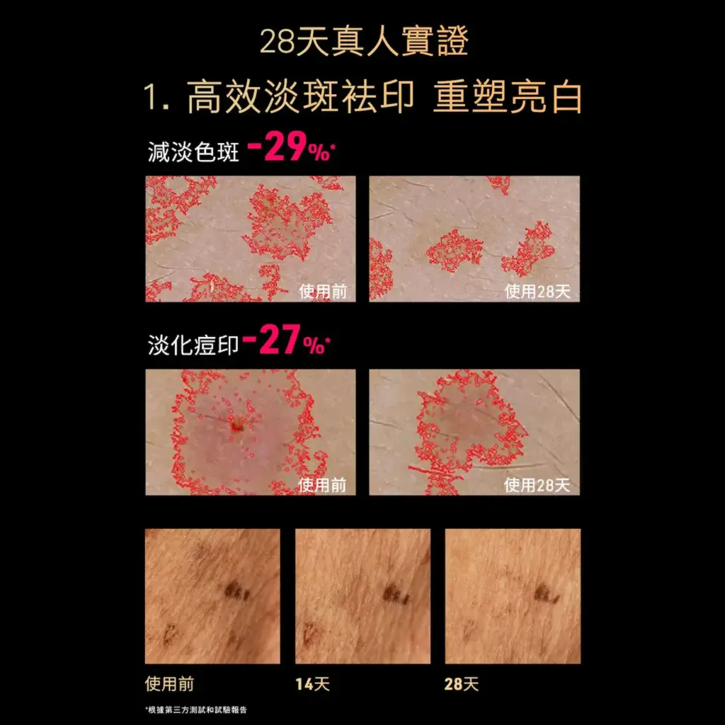 FAQ 502 Full-Spectrum Red Light Skin Rejuvenation Device