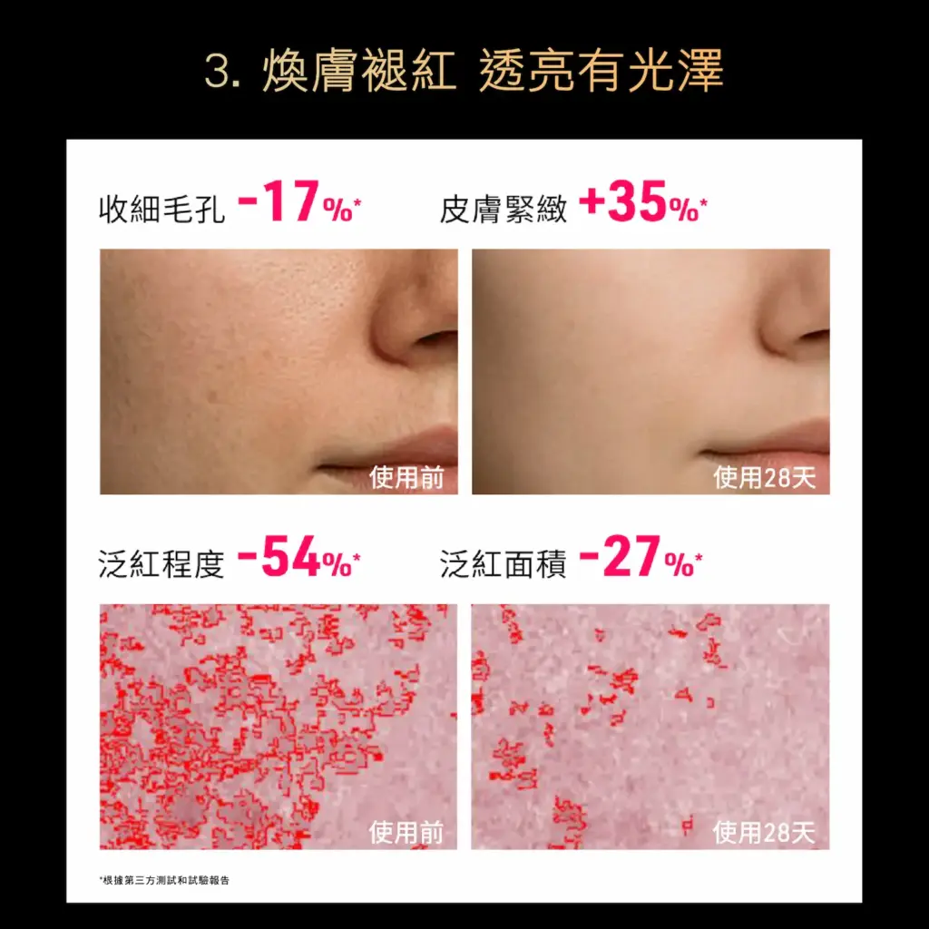 FAQ 502 Full-Spectrum Red Light Skin Rejuvenation Device