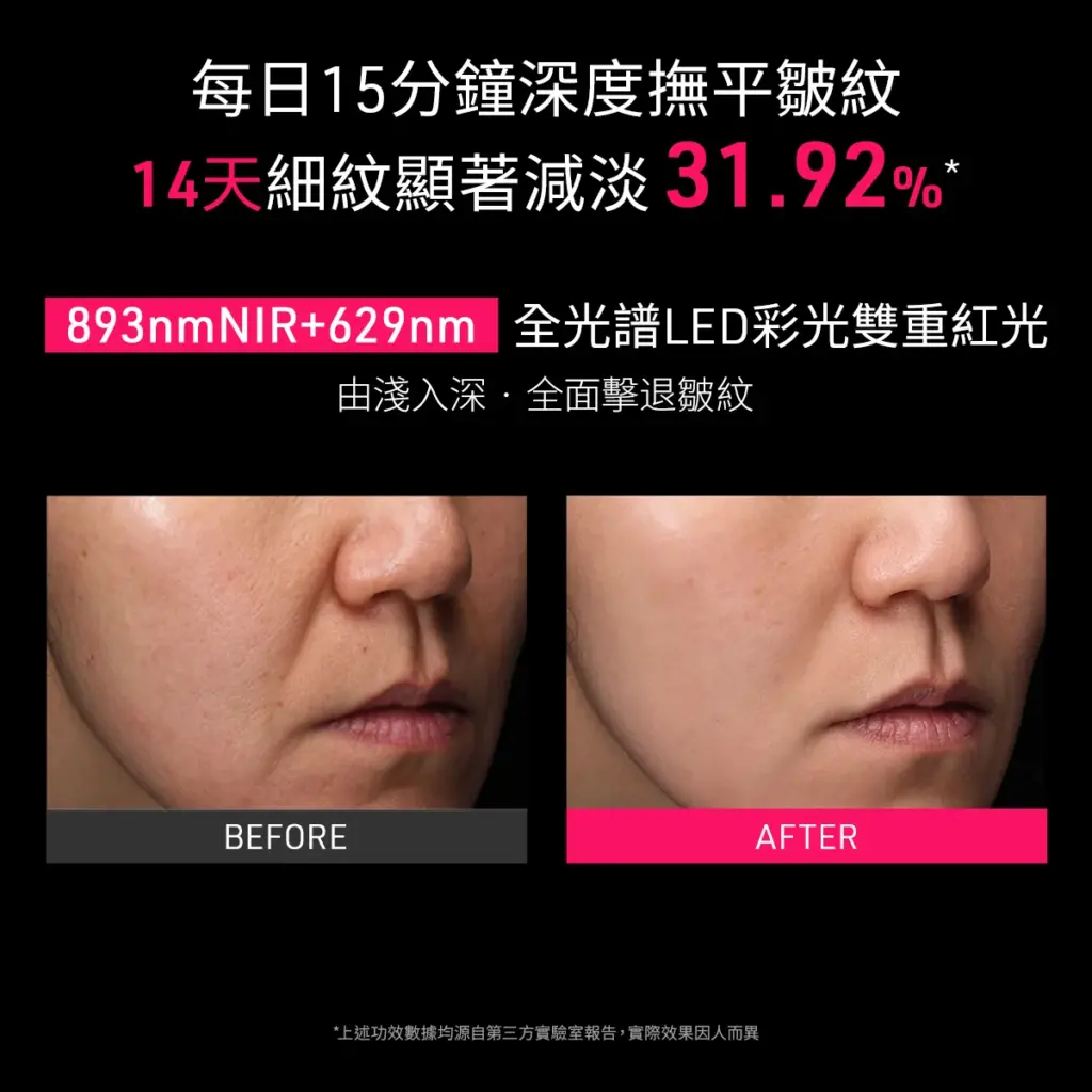 FAQ 202 PLUS 彩虹光療嫩膚面罩PLUS