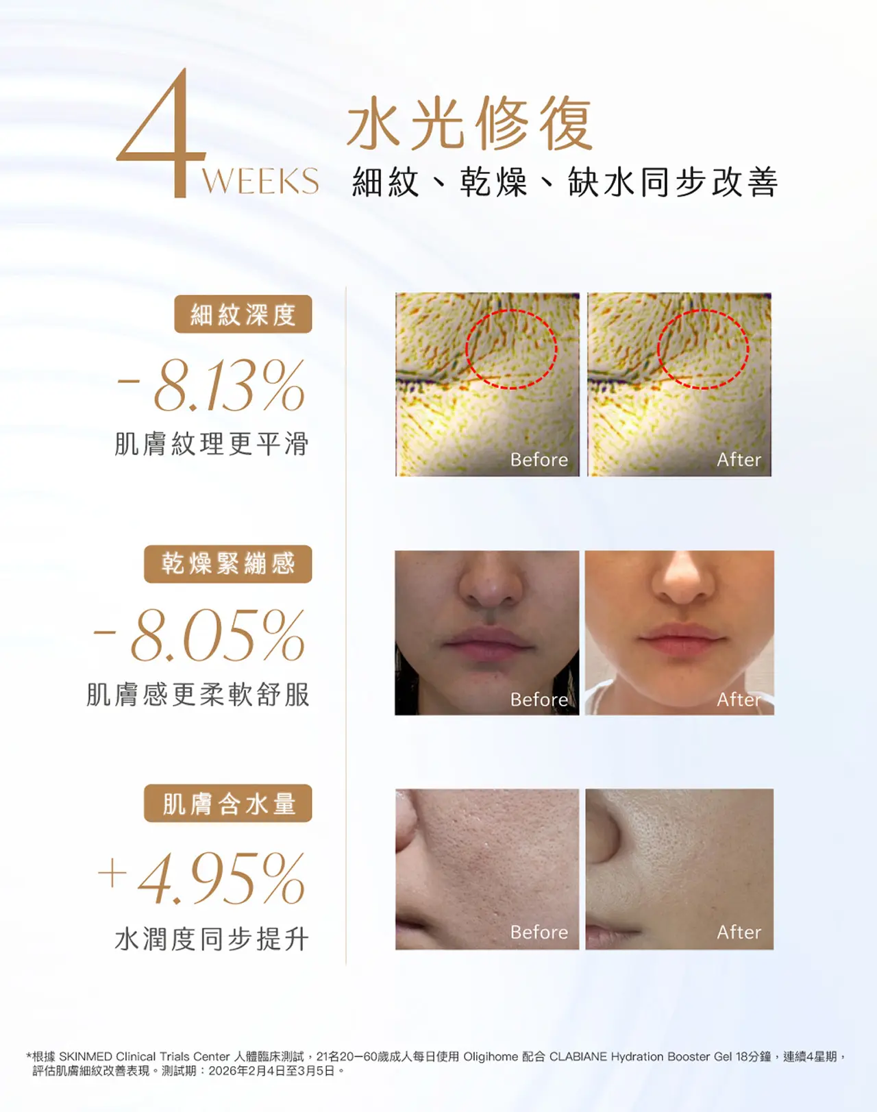 4重變頻超聲波修復效果-4星期改善細紋乾燥缺水